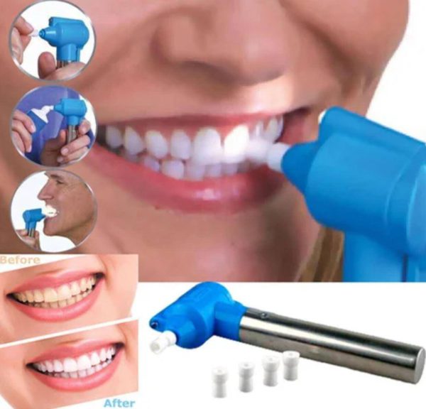 جهاز تبيض الاسنان-0